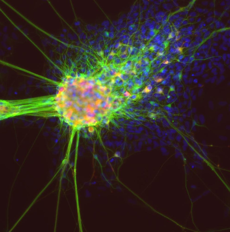 Can stem cell therapy help my chronic joint pain?